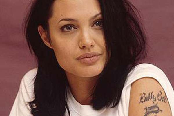 Laser tattoo removal: not for the faint-hearted
