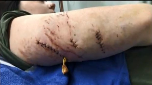 Victim of Cranbourne North dog attack, June 2018. 