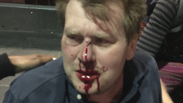 Comedian Peter Morley in a picture taken immediately after the attack.