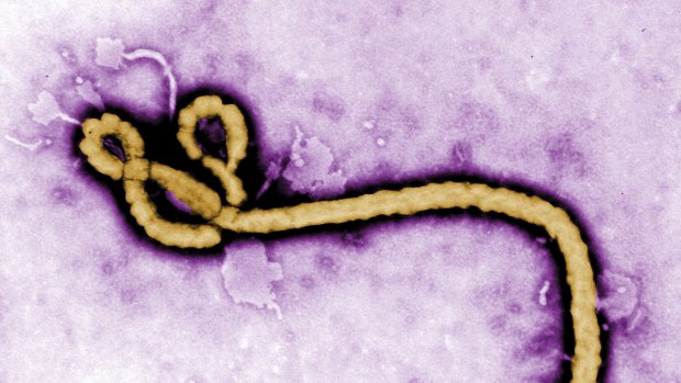 An Ebola virus virion.