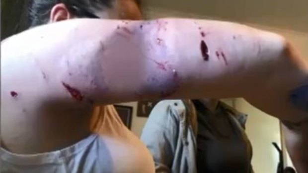 Wounds on the woman's arm. 