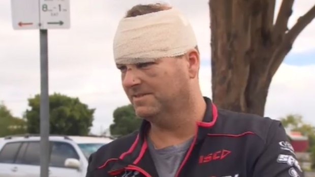 Malcolm Woodford was allegedly hit in the head with his own shovel during a fight with a couple at an isolated campsite near the Great Ocean Road on Easter Sunday. 