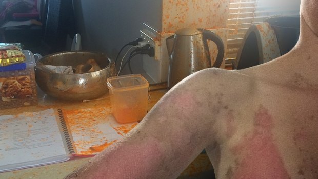 A Perth mother suffered second-degree burns to her chest, arms and stomach after her Thermomix unexpectedly burst open while she was preparing dinner.
