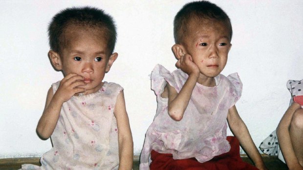 Children between the ages of four and five suffering from malnutrition are pictured in a nursery in Anpyon County, Kangwon province, in hunger-stricken North Korea in 1997.