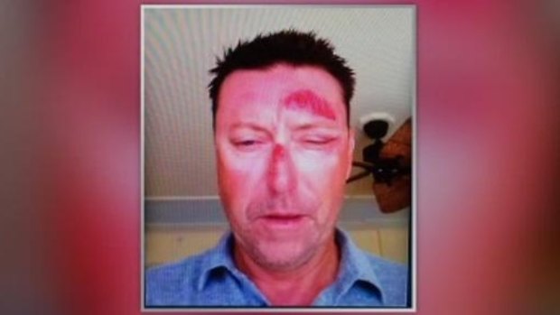 Robert Allenby after the incident in Hawaii.
