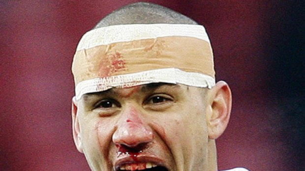 Leeds United's Patrick Kisnorbo celebrates after beating Manchester United in their FA Cup clash.