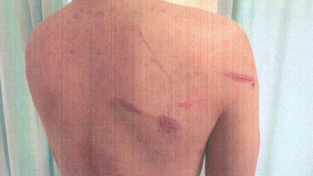 Some of the injuries inflicted on the two fishermen in the early hours of Saturday morning off a small inlet near Ascot Waters.