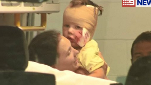 A dog has mauled a young child on the face in Melbourne's outer east.
