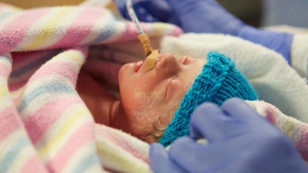 Lucia Cadei, just after being born in an emergency c-section. “She’s 1850grams, with a hat and a nappy - and a tube," the nurses said. 