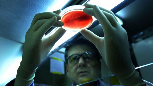 Professor Alan Cowman inspects a petri dish of human blood with malaria parasites.