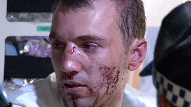 Face of violence: a man bears the scars of an assault at Haymarket on Friday night.