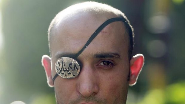 Ahmed El-Belasy, 31, was shot in the right eye during the revolution in January.