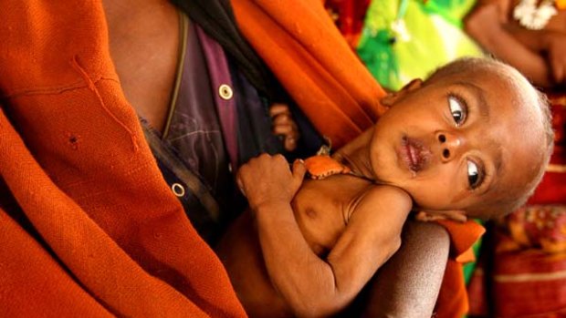 Ten-month-old Shamisiya Hamda who was suffering malnutrition  is nursed by her mother at the MSF Belgium clinic in Southern Ethiopia.