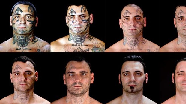 Transformation ... Bryon Widner had multiple operations to remove his tattoos.