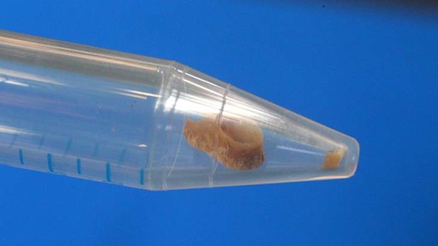Genetic insights: Phar Lap's tooth.