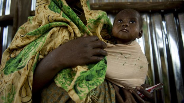 A mother with her baby in a medical centre in Somalia where malnutrition rates are high.