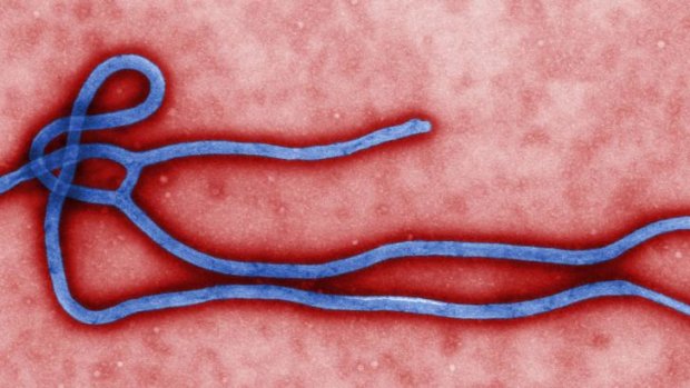 The ebola virus, which has killed nearly 700 people in west Africa.
