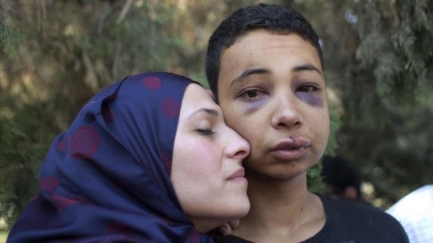 Tariq Abu Khedair, 15, with his mother. Tariq, a cousin of Mohammed, was beaten by Israeli border police officers.