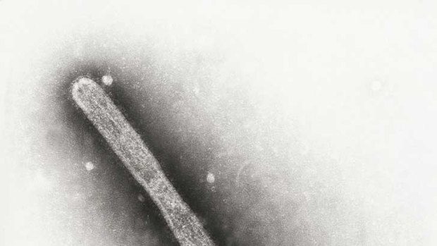 This  transmission electron micrograph taken at a magnification of 150,000x, reveals the ultrastructural details of an avian influenza A (H5N1) virion, pictured by the United States government's Centre for Disease Control.