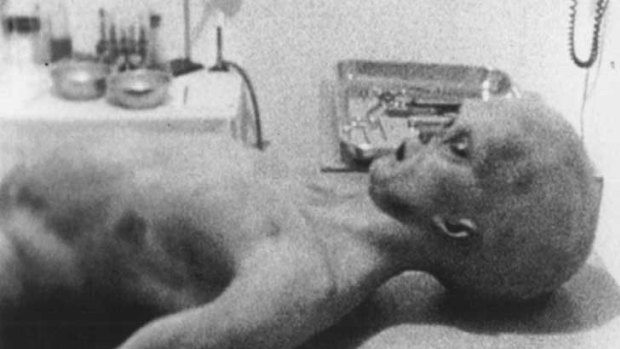 Image of a purported "alien" from a documentary on the Roswell incident.