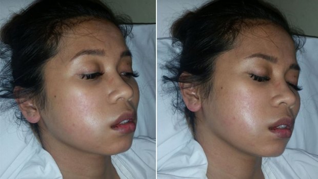 Ms Van Luyn posted to social media to display the swelling on her face and call for information.