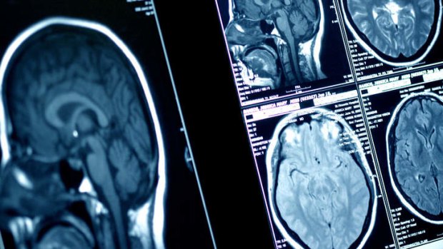 Devastating disease:  Brain cancer kills more children than any other cancer.