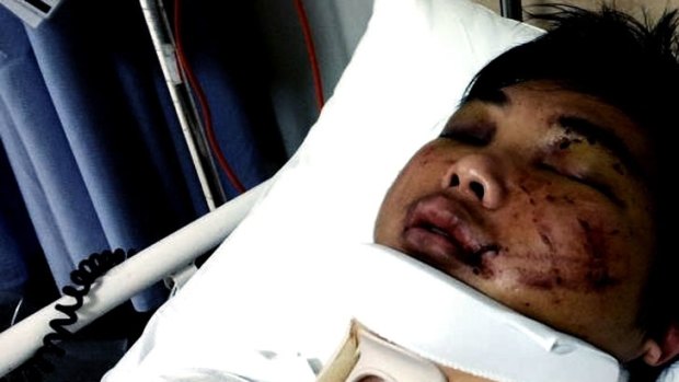 Gang attack victim Minh Duong in hospital.
