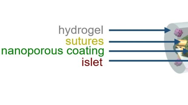 A schematic illustration of TRAFFIC, the implant device for control of type 1 diabetes developed in the lab of Minglin Ma, biological and environmental engineering. 