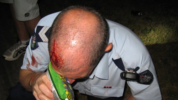 The policeman hurt in the Boronia fracas.