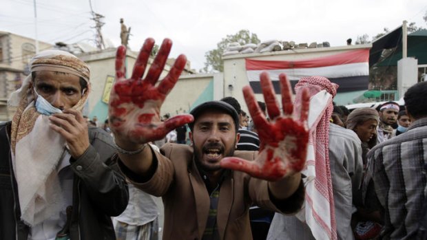 Unbowed ... an anti-government protester show his blood-stained hands after clashes with security forces in Sanaa.