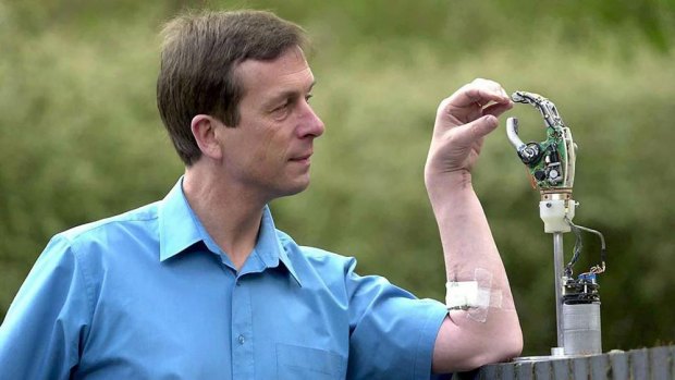 Professor Kevin Warwick and his Cybernetic Arm.