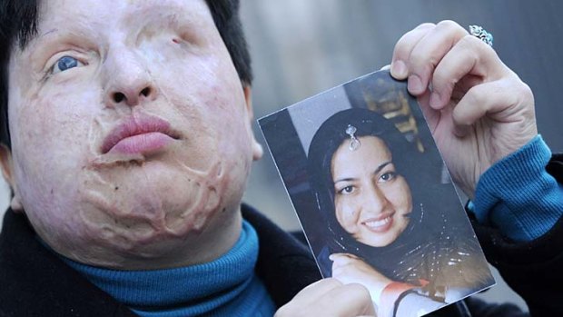 Forgave her attacker ...  Ameneh Bahrami holds a photograph of herself before she was blinded by a man who threw acid in her face.