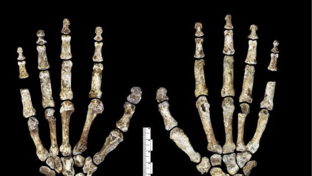 The features of <i>Homo naledi</i> are similar to other early hominids, with human-like face, feet and hands.