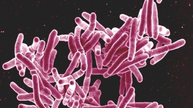 Scanning electron micrograph of mycobacterium tuberculosis bacteria, which cause TB. 