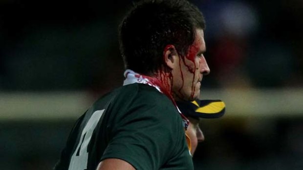 Bloodied mess ... Mitch Chapman leaves the field after the incident.