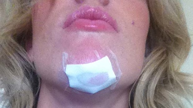 Katherine Feeney's bandaged face.