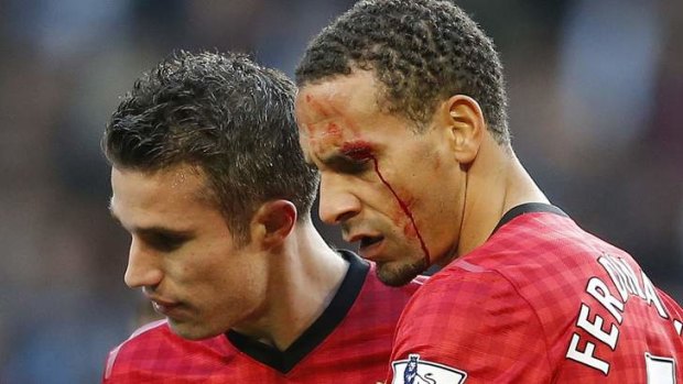Rio Ferdinand suffered a cut to the eye after being hit by a coin thrown from the crowd.