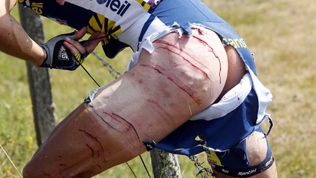 The damage done to Vacansoleil-DCM rider Johnny Hoogerland of the Netherlands after a crash into a barb wire fence.