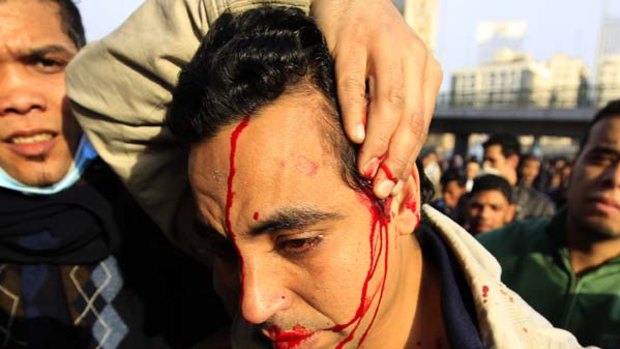 An injured protester in Cairo.