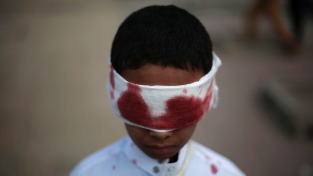 A boy with fake blood on his face and clothes to represent a victim participates in a protest against Saudi-led airstrikes in Sanaa, Yemen, Sunday, Nov. 27, 2016. (AP Photo/Hani Mohammed)