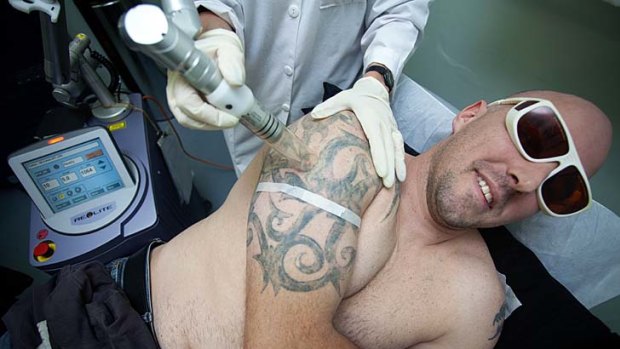 Conan Blake getting  at the tattoo removal clinic.