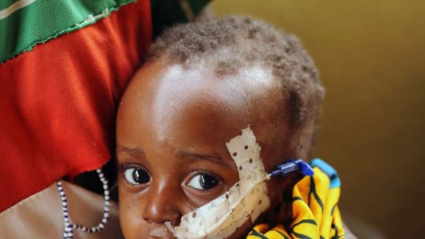 Famine victim &#8230; Ouobra Kompalemba, 2, is fed milk through a tube in a Burkina Faso hospital.