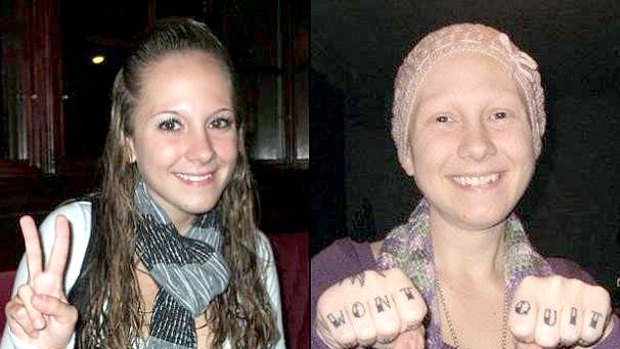 Ashley Anne Kirilow is accused of faking breast cancer to make money. She allegedly posted these images of herself on a charity Facebook page.