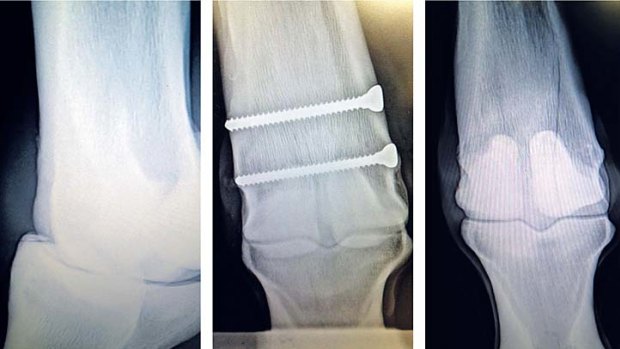 Inside information: Hard tracks can lead to numerous injuries. The pictures show (from left) a chipped fetlock, a repaired cannon bone fracture and a cannon bone fracture pre-operation.