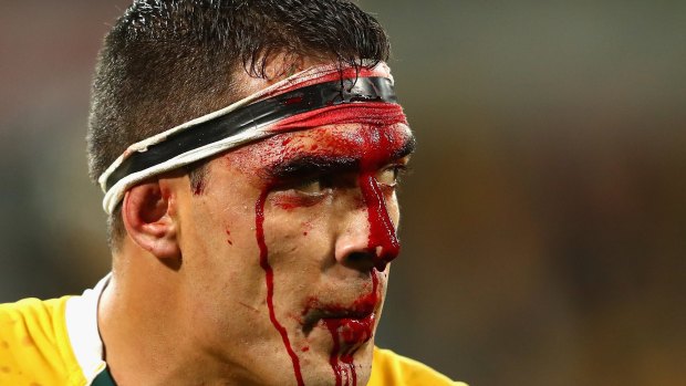 Split open: Wallabies forward Rory Arnold bleeds from his head during the Test between the Wallabies and England at AAMI Park.