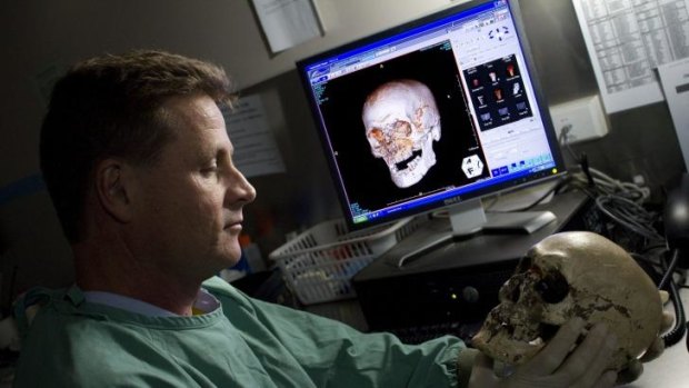 Dr Richard Bassed holds the skull, with its photo-superimposition on the screen behind him.