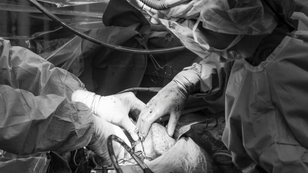 This image shows the removal of the recipient's original liver. Surgeons have detached all the arteries and veins from the adjacent organs. As of May 2016 there were 141 Australians on the waiting list for a liver. There were 1034 Australians waiting for a kidney. Supplied pix from Andrew Chapman August 2016? picture are for use only when promoting?www.donatelife.gov.au?