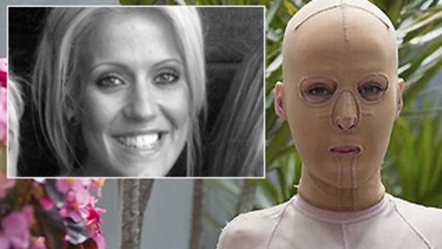 Burn victim Dana Vulin has written about her long road to recoevry.