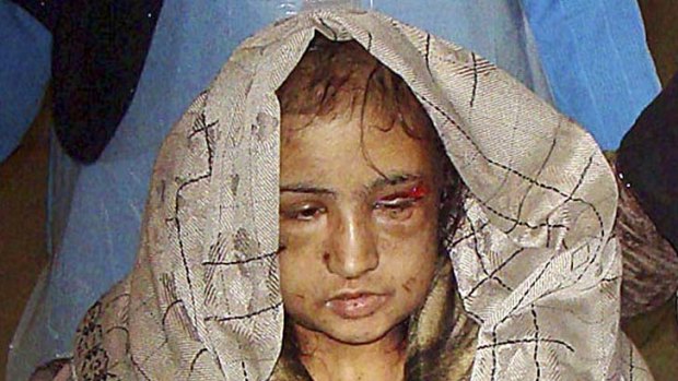 Tortured ... Sahar Gul, a 15-year-old Afghan wife, pictured here on December 28.