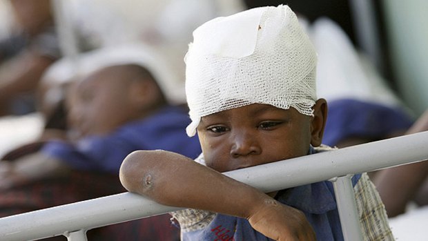 An inured baby boy recuperates in the University de la Paix hospital in Port-au-Prince.